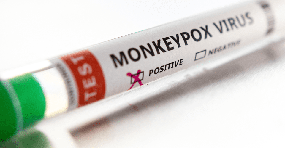 240907_test-monkeypox_reuters